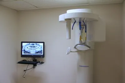 CBCT 3D X-ray unit
