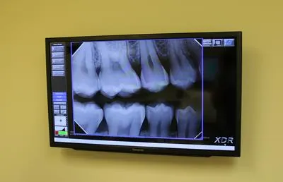 X-rays displayed on an exam room screen