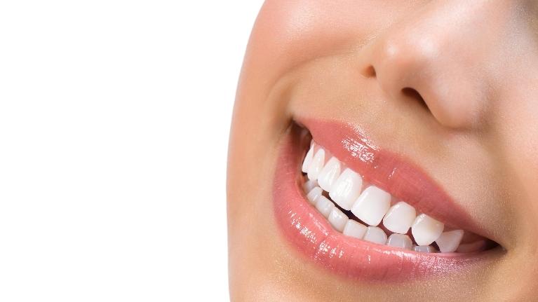 A Smile Makeover Doesn't have to Be Complicated. Consider These Easy Cosmetic Dentistry Options