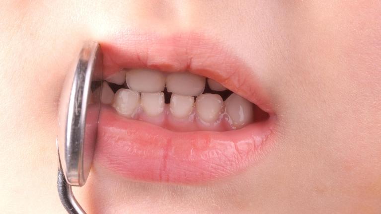 How to Achieve Lifelong Oral Health