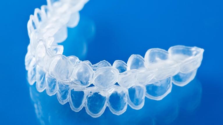 Options for Adult Orthodontics