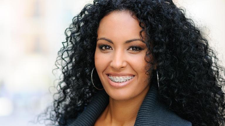 Orthodontic Issues That Affect Your Health