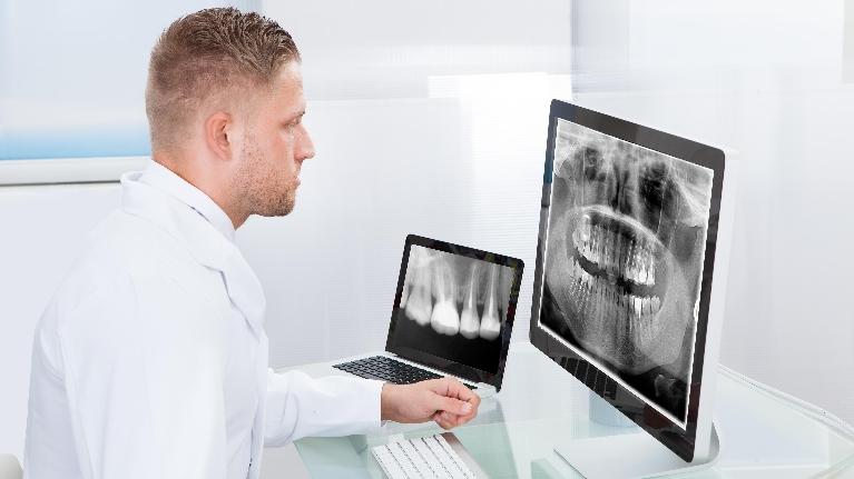 Top 5 Foods and Drinks That Stain Your Teeth