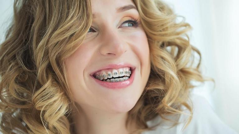 What Are the Benefits of Straighter Teeth?