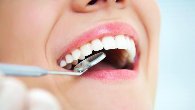 What Can You Expect at Your Teeth Whitening Appointment?