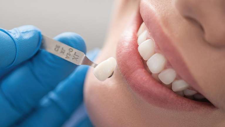 All You Need to Know: The Benefits of Cosmetic Dentistry in Elk Grove Village