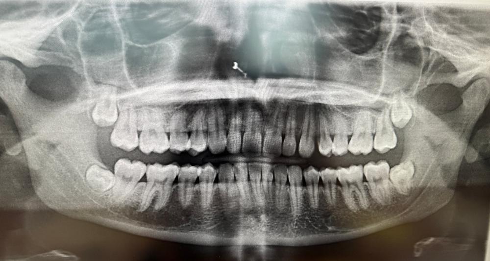 Digital xray in Elk Grove Village, IL