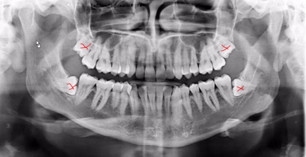 Digital xray in Elk Grove Village, IL