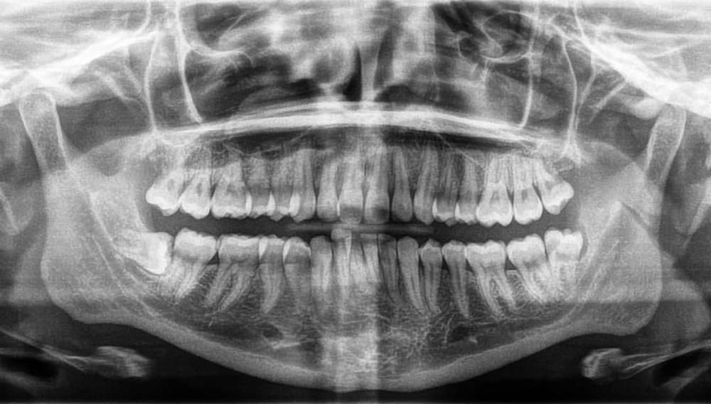 Digital xray in Elk Grove Village, IL