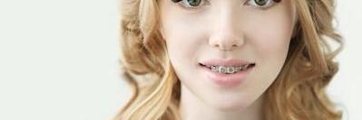 Lady smiling after getting braces from Elk Grove Smile Center