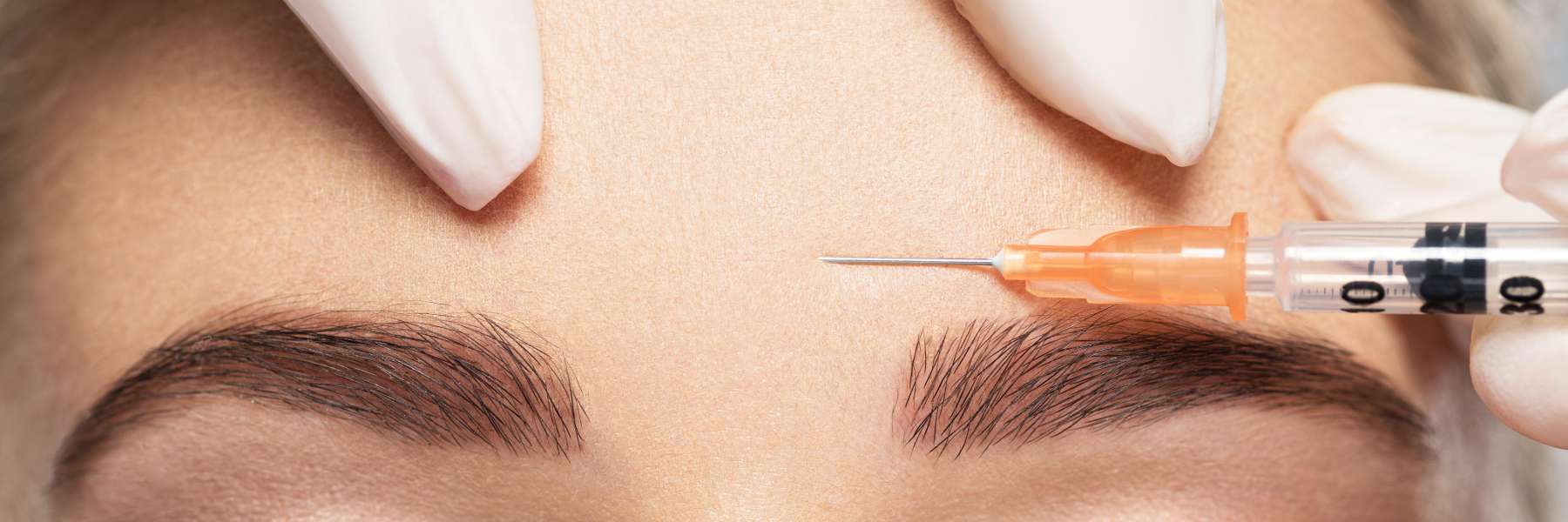A close up of a BOTOX injection in Elk Grove Village. IL