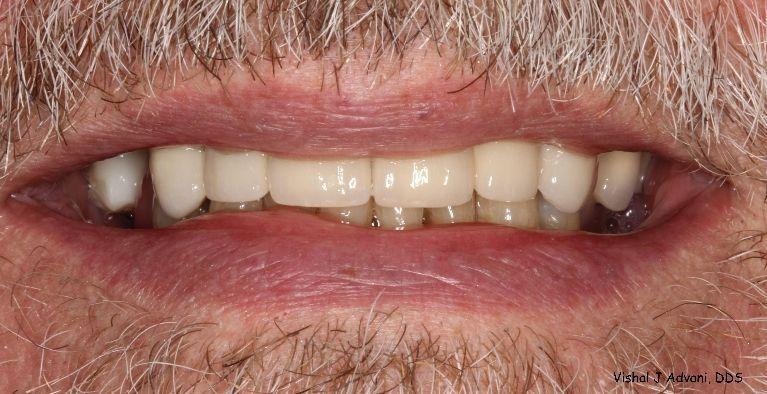 cosmetic dentistry after elk grove village