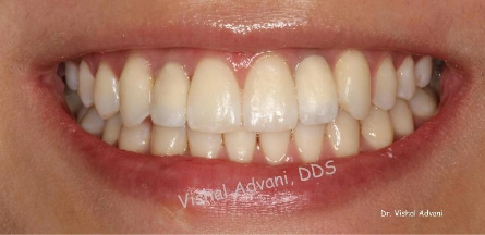 Elk Grove Smile Center