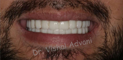 Elk Grove Smile Center