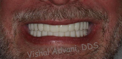 Elk Grove Smile Center