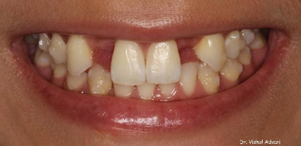 Elk Grove Smile Center