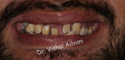 Elk Grove Smile Center