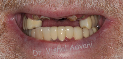 Elk Grove Smile Center