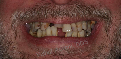 Elk Grove Smile Center